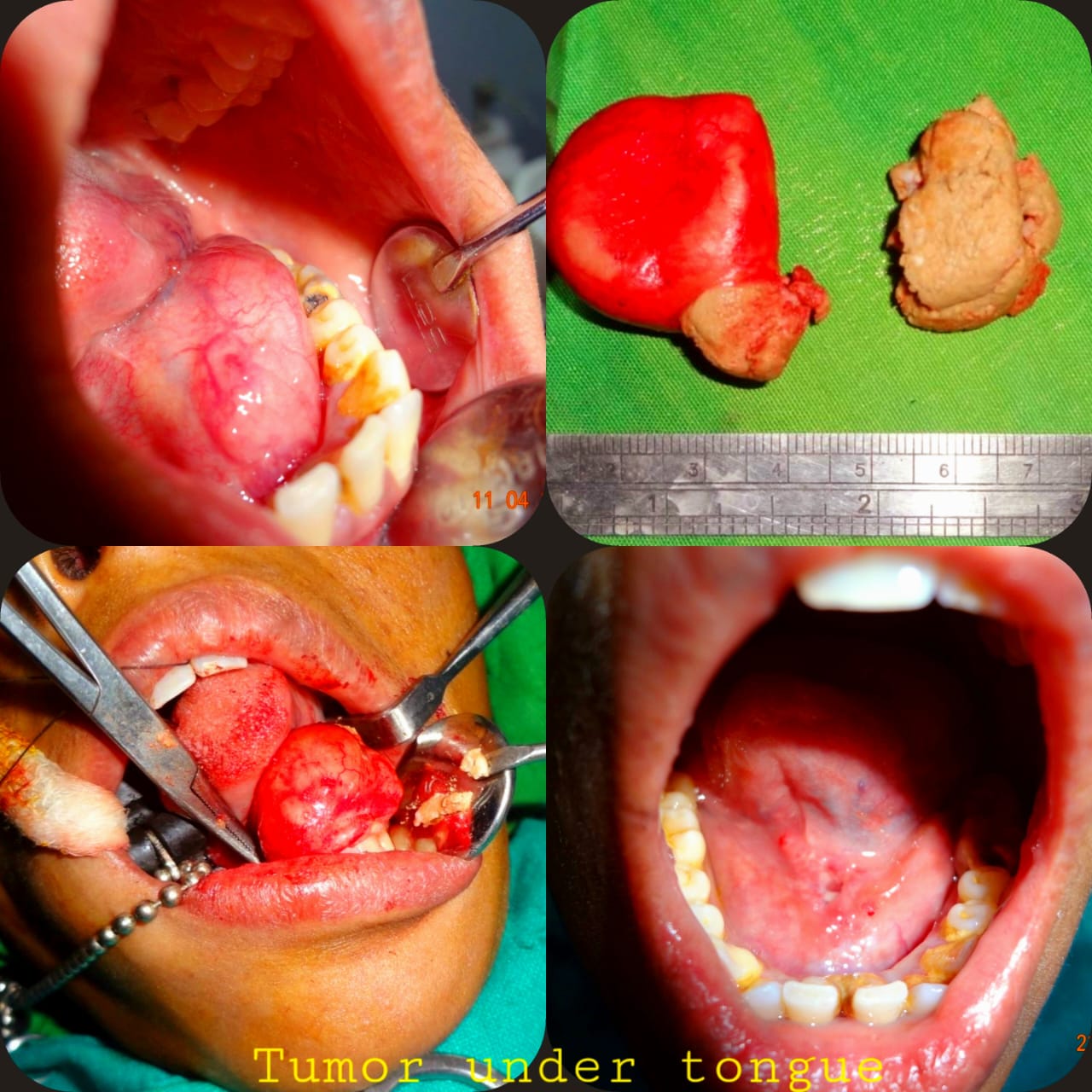 Surgical Case 8