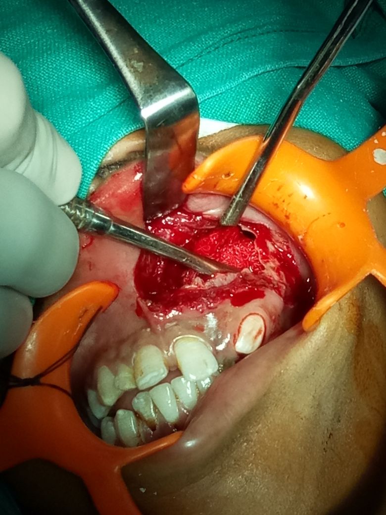Surgical Case 3