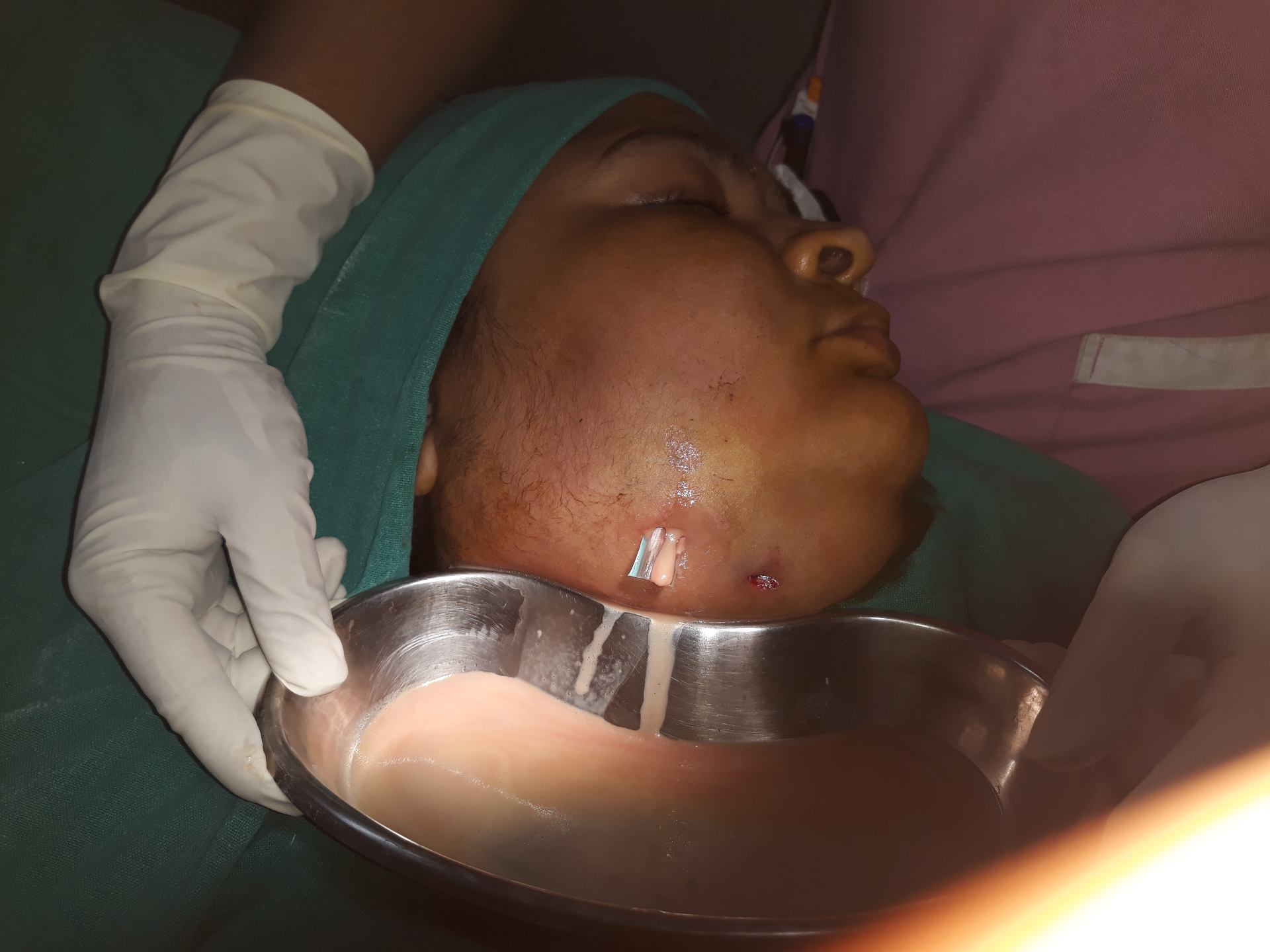 Surgical Case 1