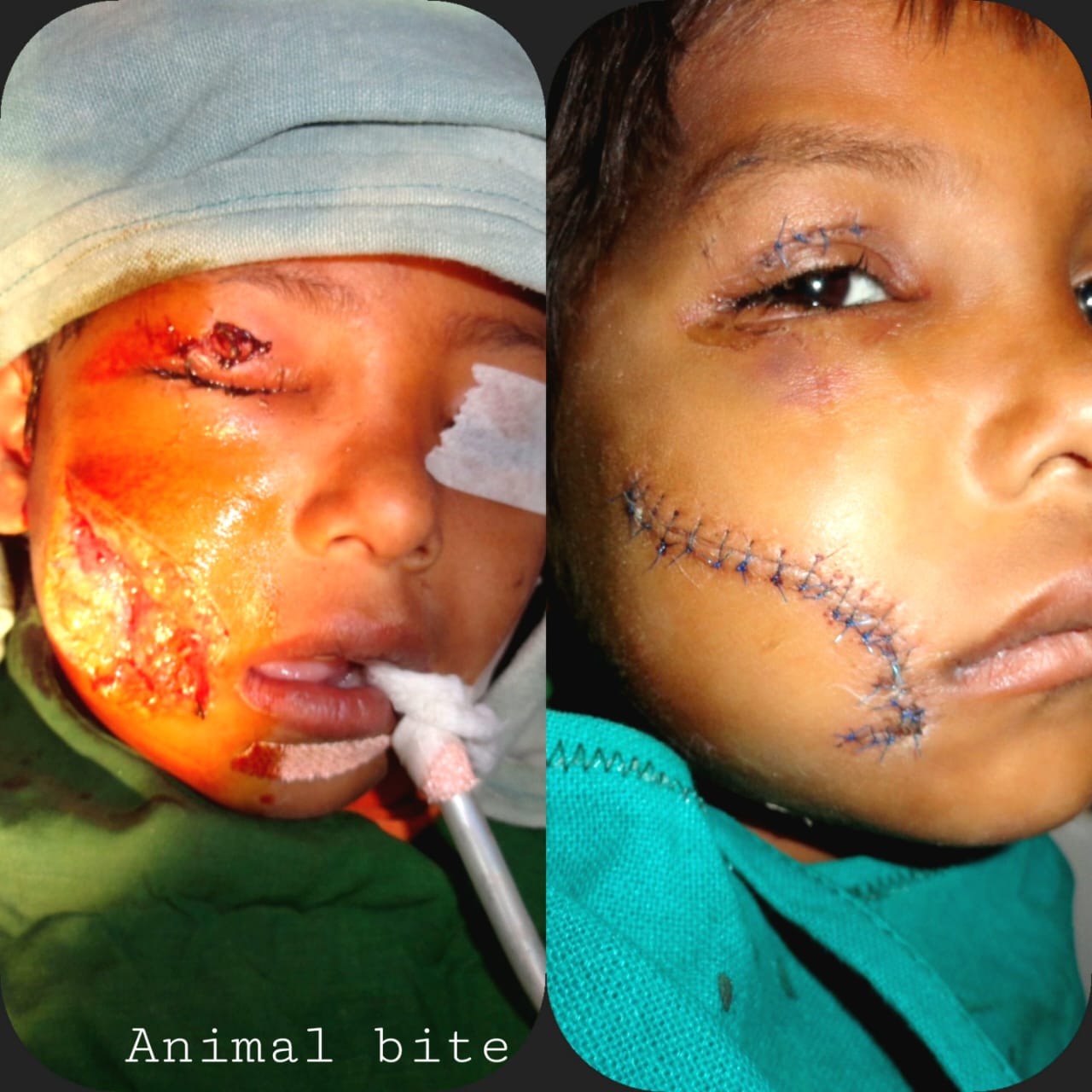 Surgical Case 14