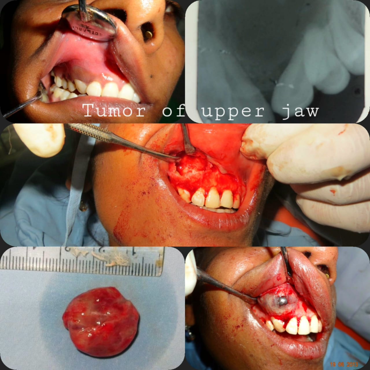 Surgical Case 15