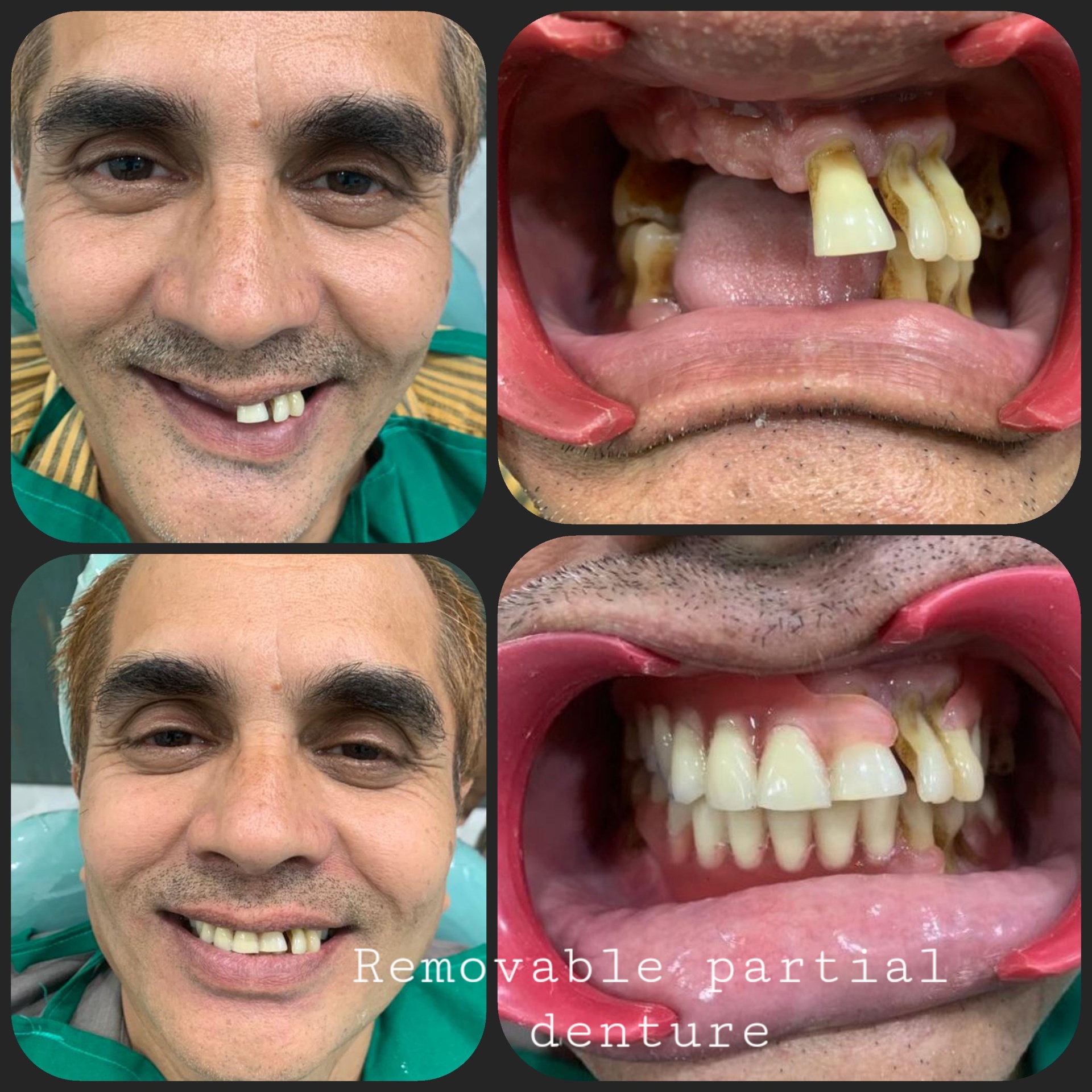Happy Patient 12