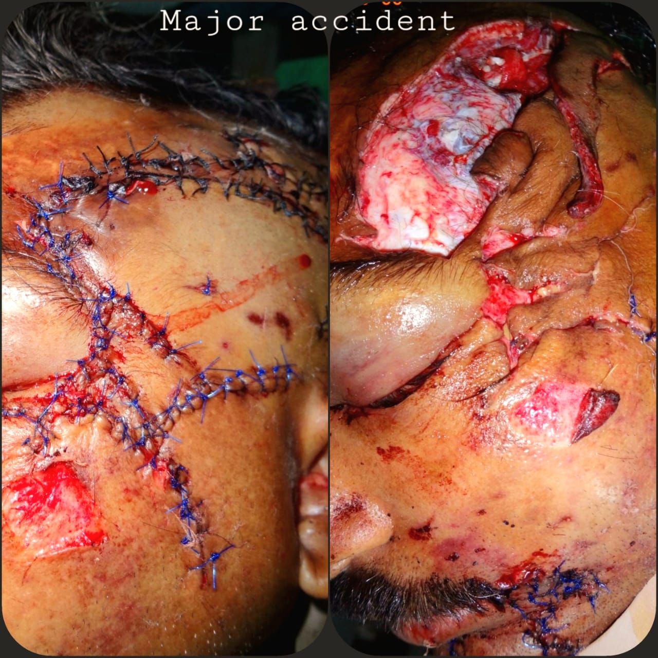 Surgical Case 9