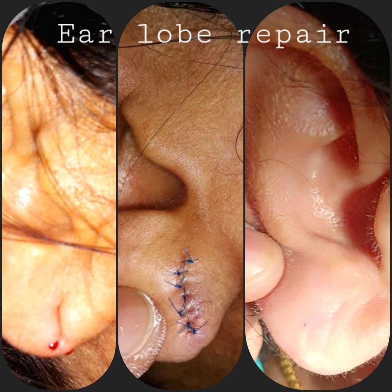 Surgical Case 11
