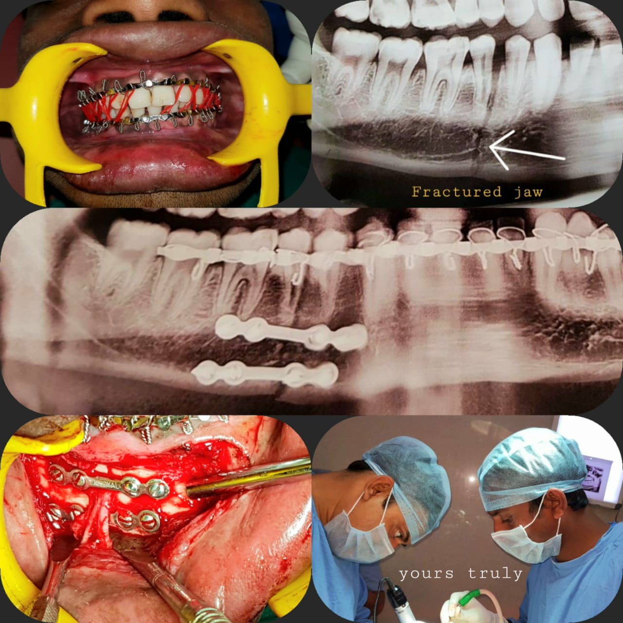 Surgical Case 16