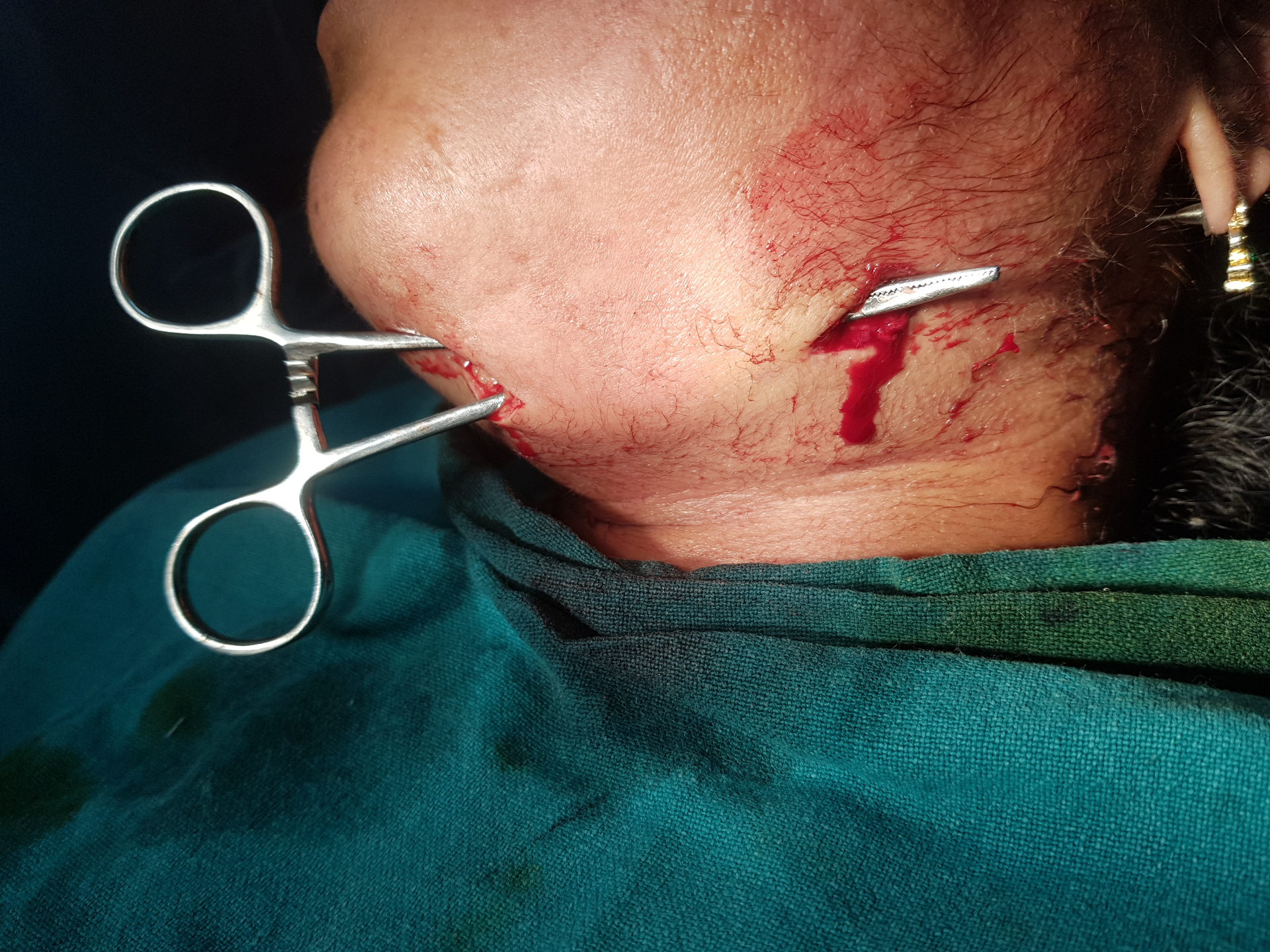 Surgical Case 2