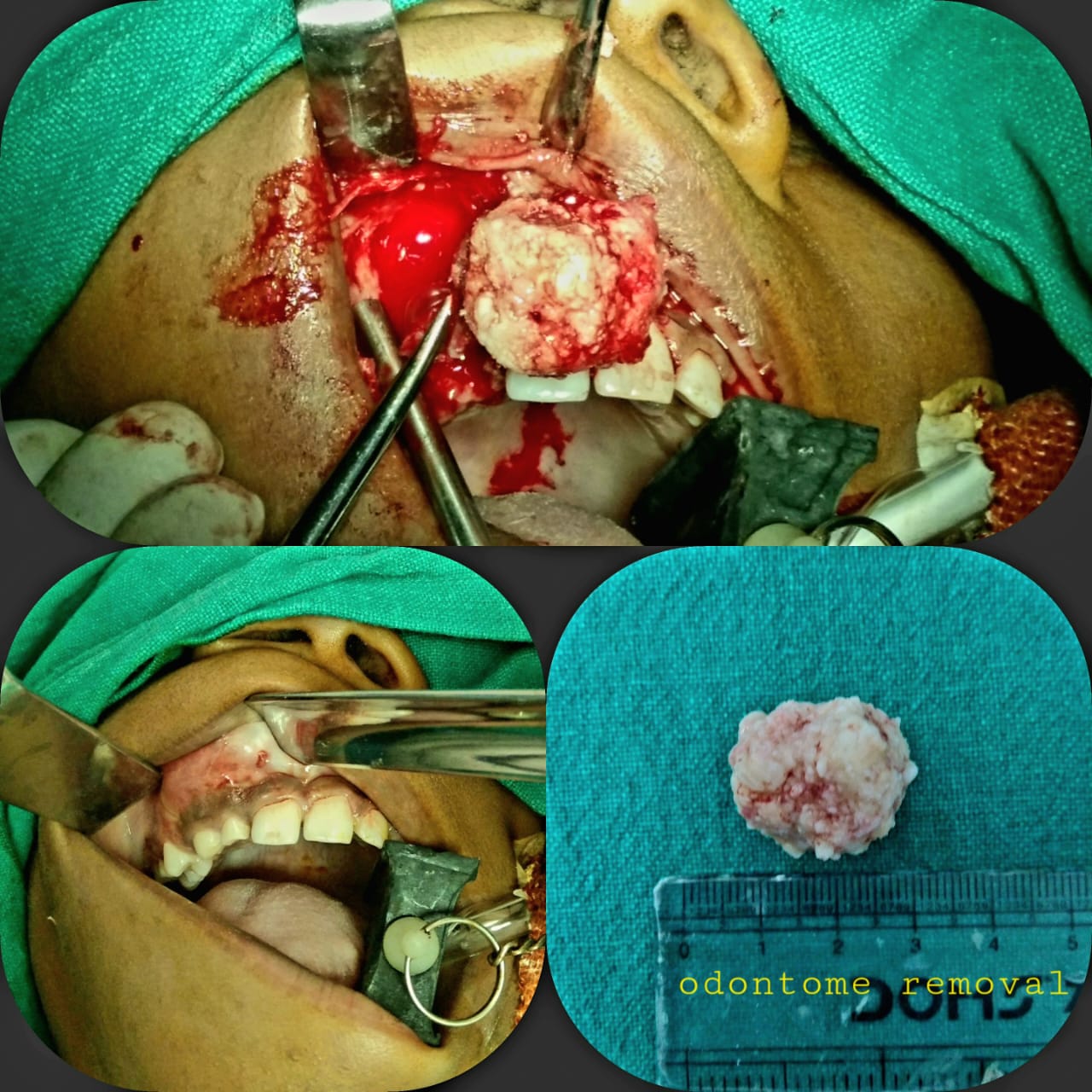 Surgical Case 13